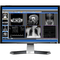 Sante PACS Server 4.5